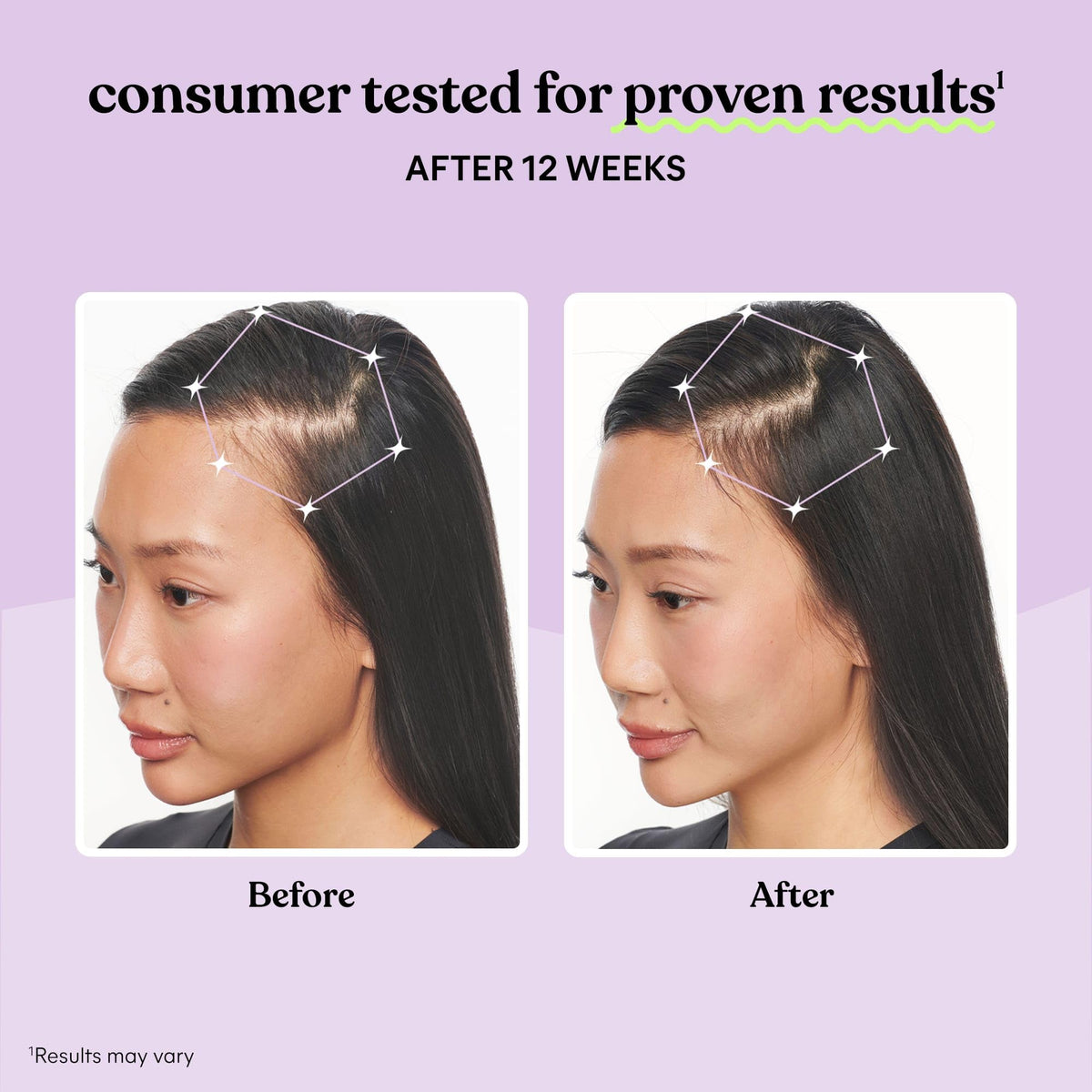 Hair Growth Capsules 30-Day Supply T353