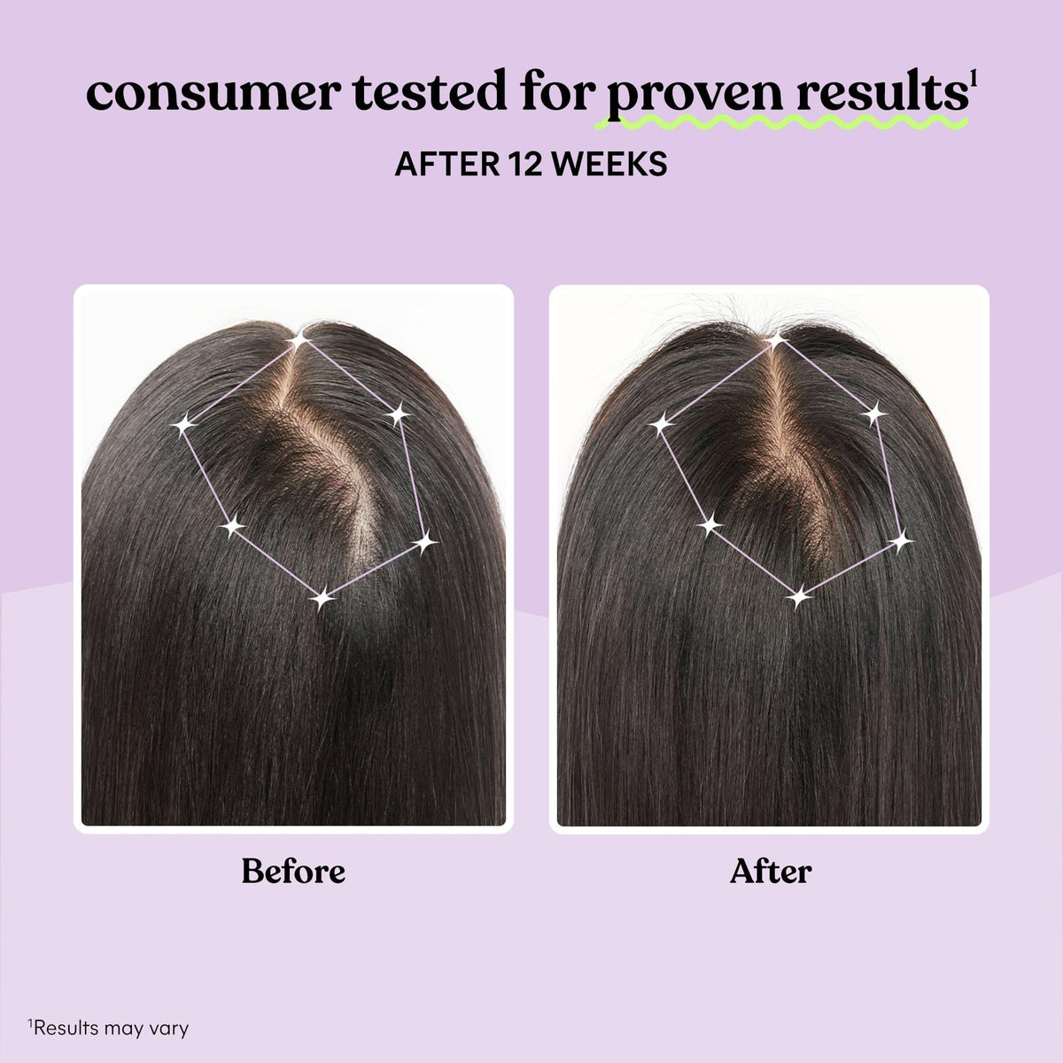 Hair Growth Capsules 30-Day Supply T353